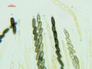 Anthostoma gastrinum, 