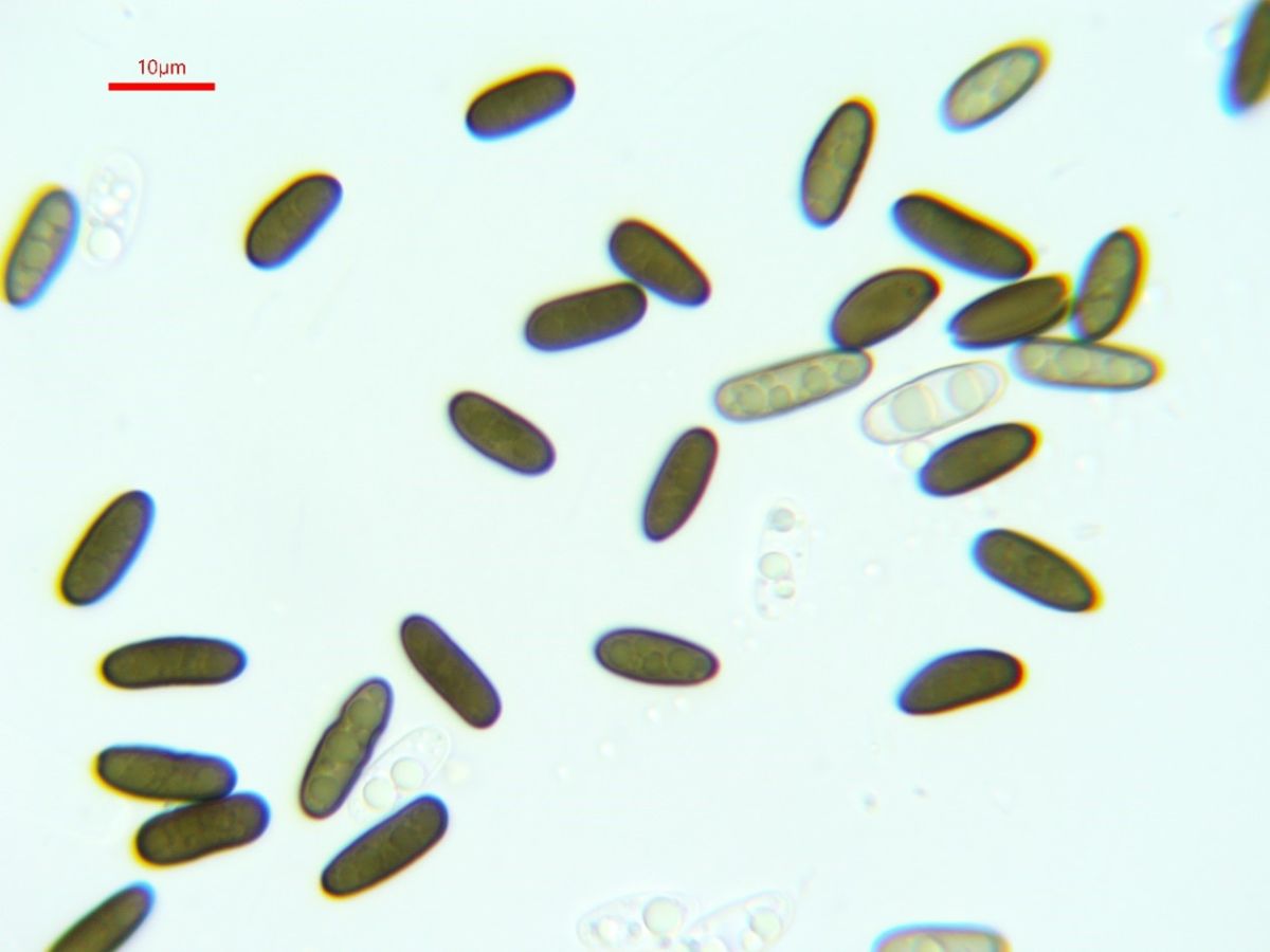 Anthostoma gastrinum