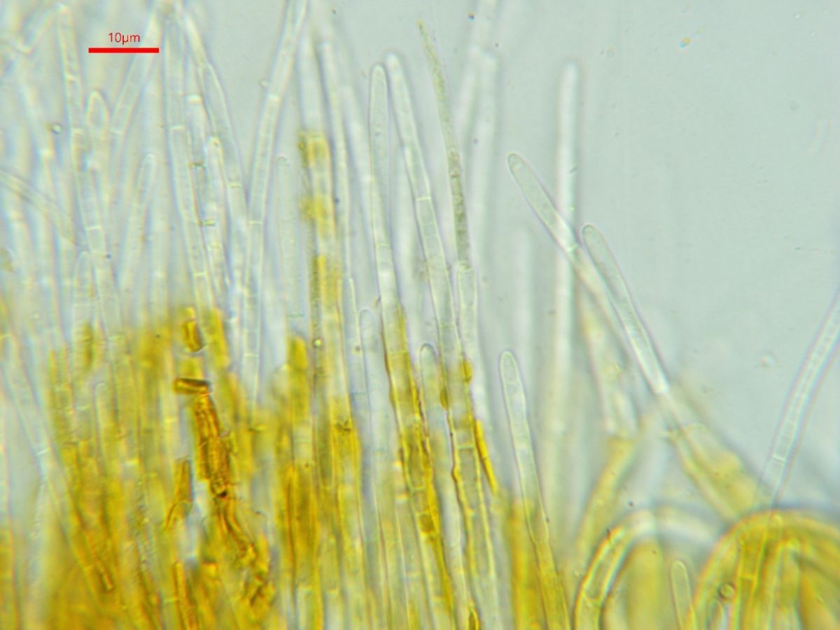 Arachnopeziza aurelia