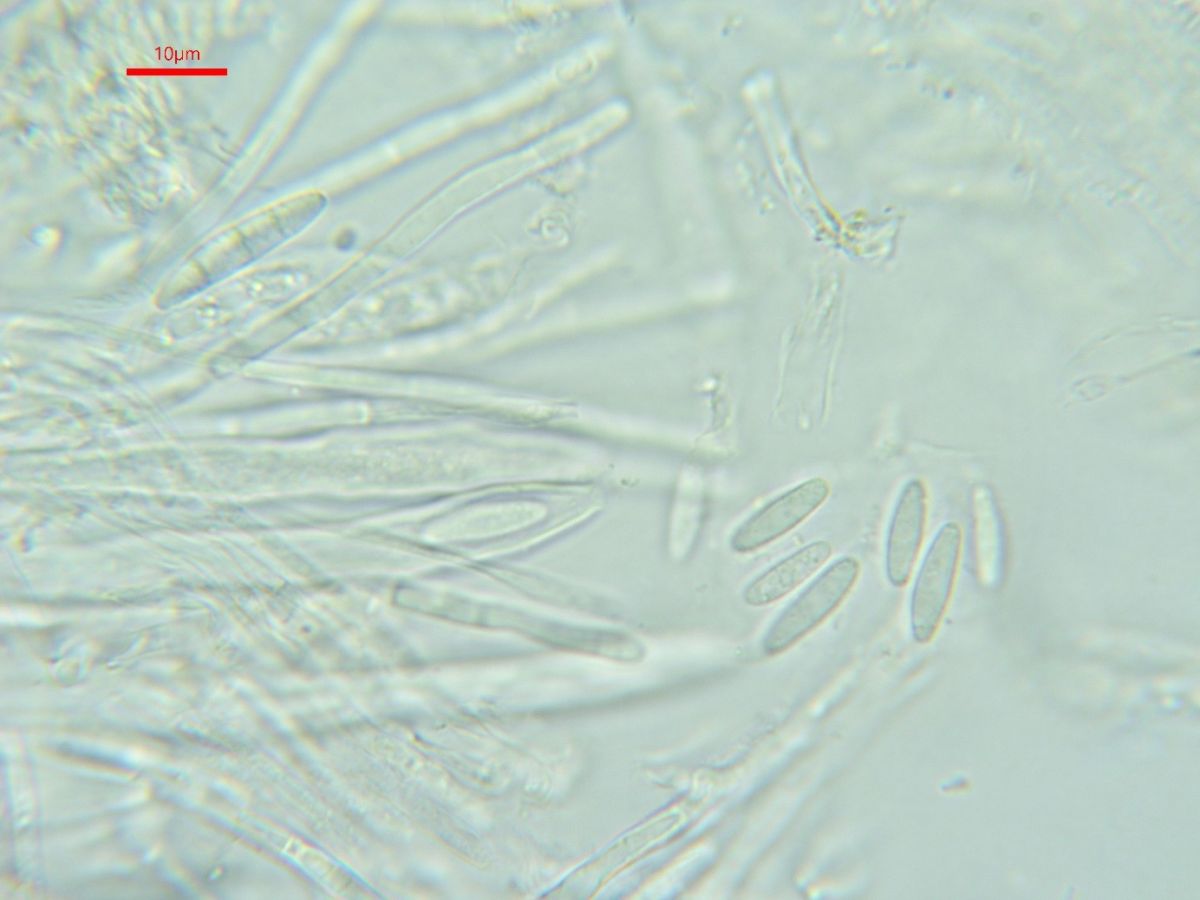 Arachnopeziza aurelia