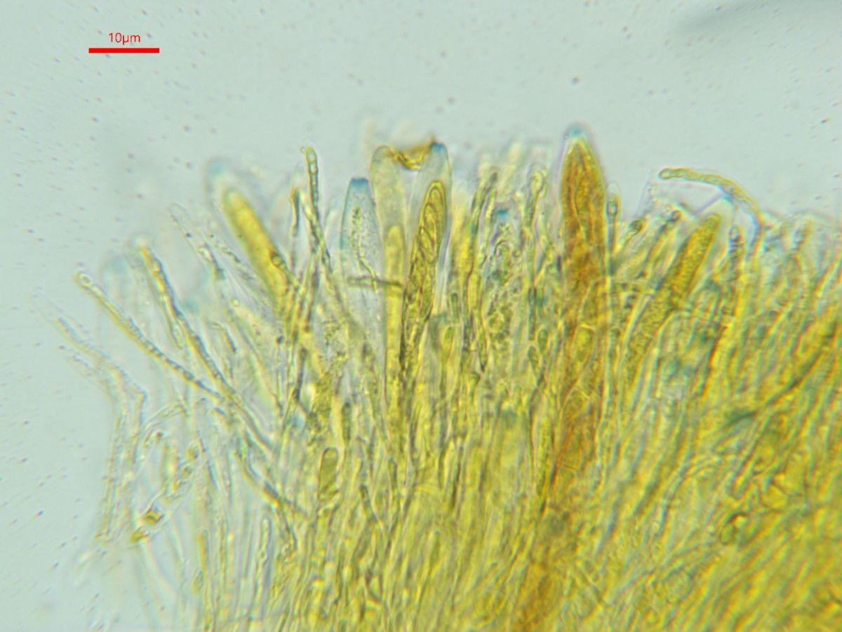 Arachnopeziza aurelia