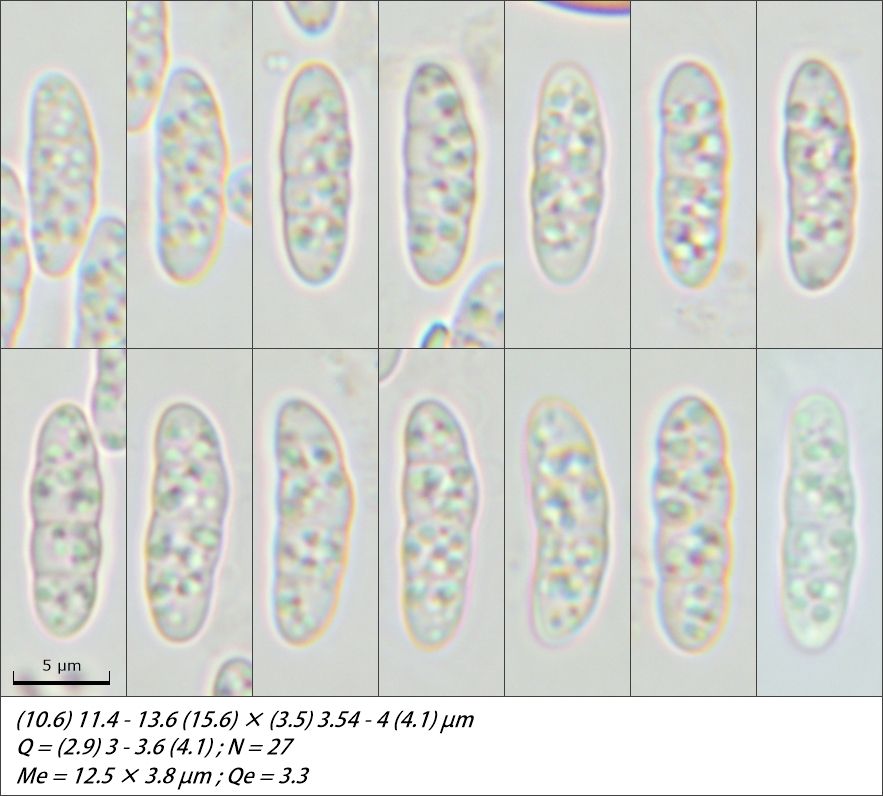 Claussenomyces prasinulus