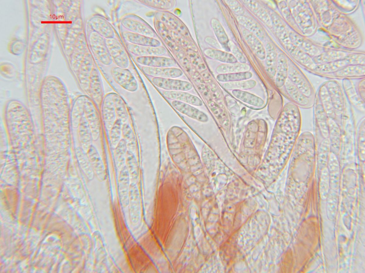 Claussenomyces prasinulus