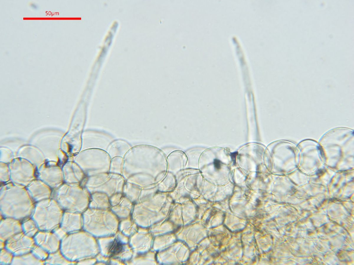 Coprinellus verrucispermus