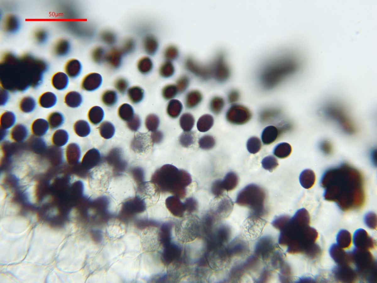 Coprinopsis rugosomagnispora