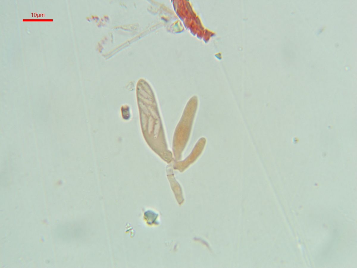 Hyalopeziza millepunctata