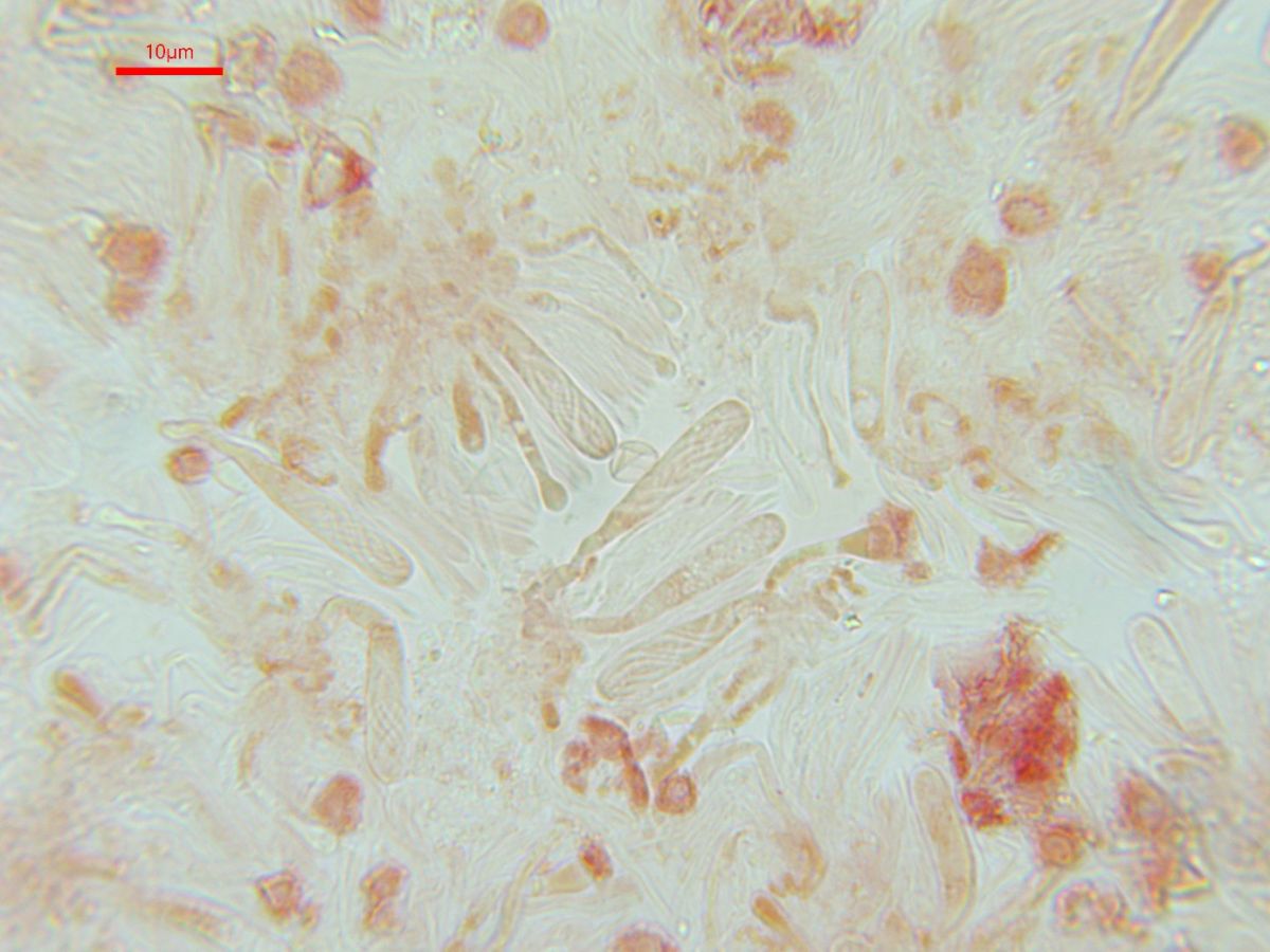 Orbilia crenatomarginata