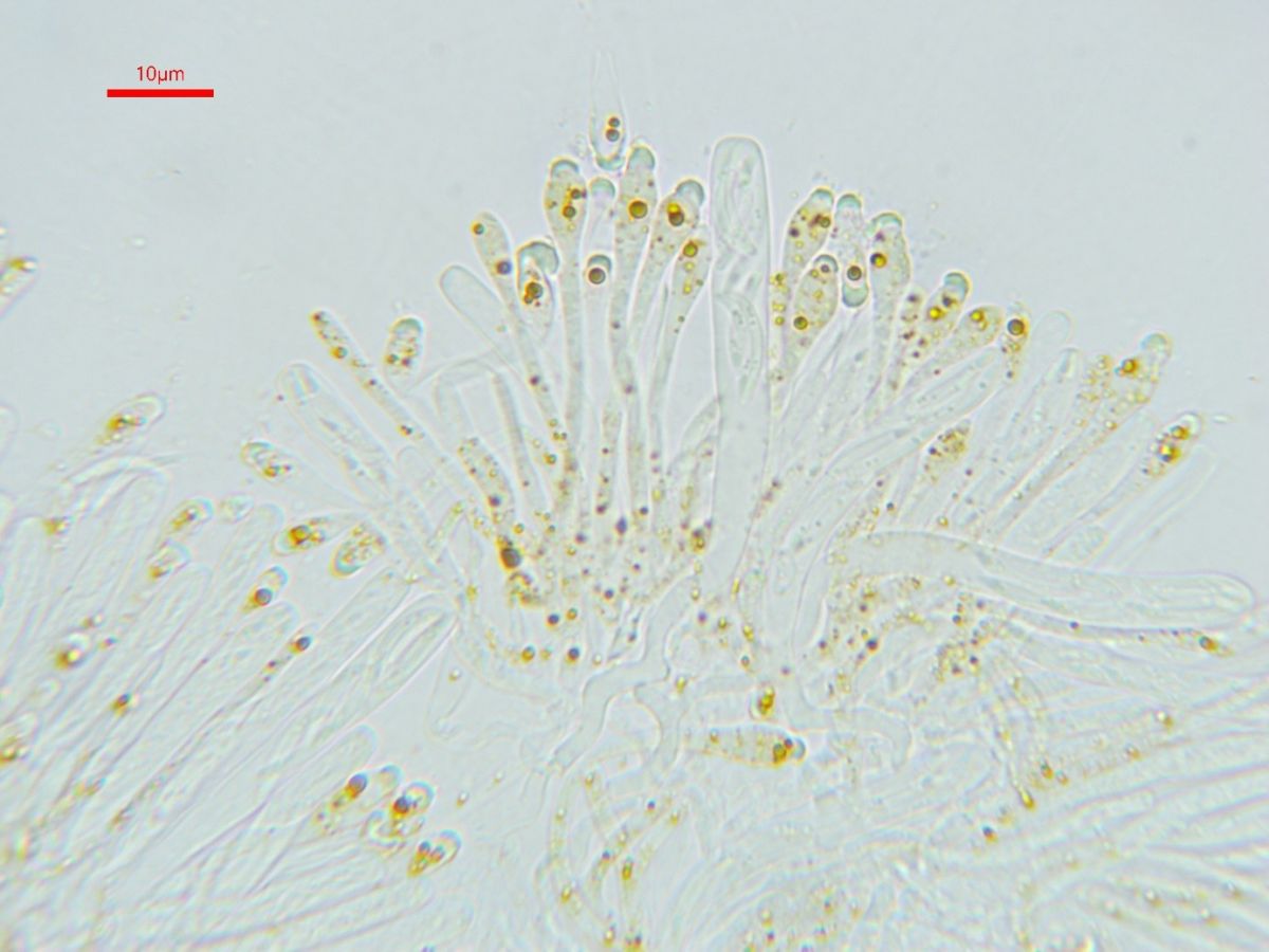 Orbilia xanthoguttulata