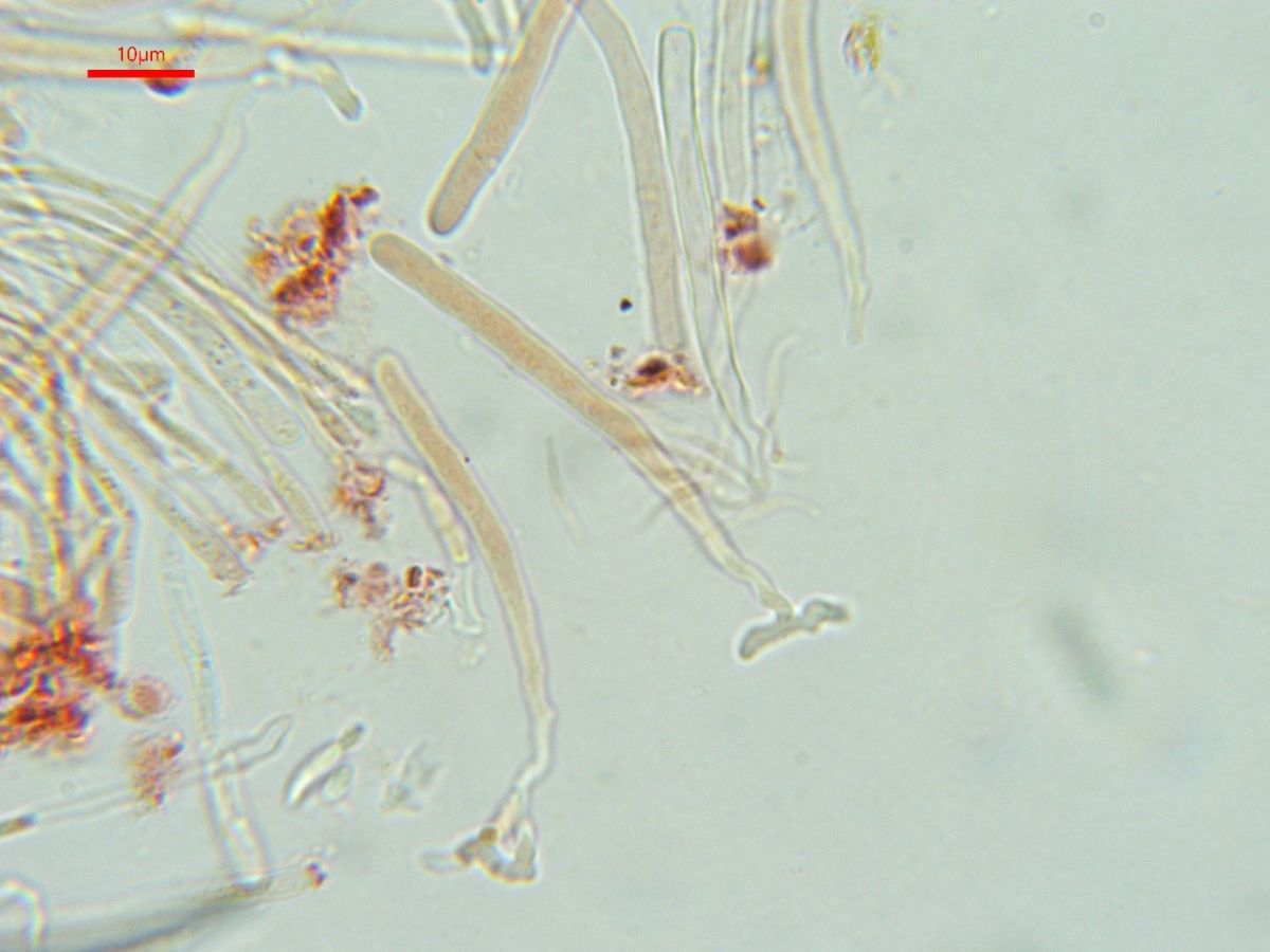 Orbilia xanthoguttulata