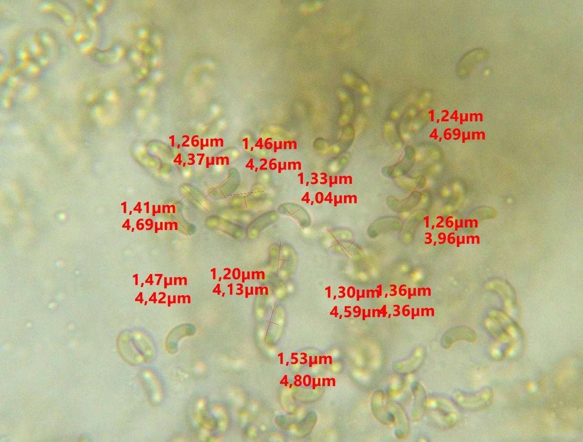 Peroneutypa scoparia