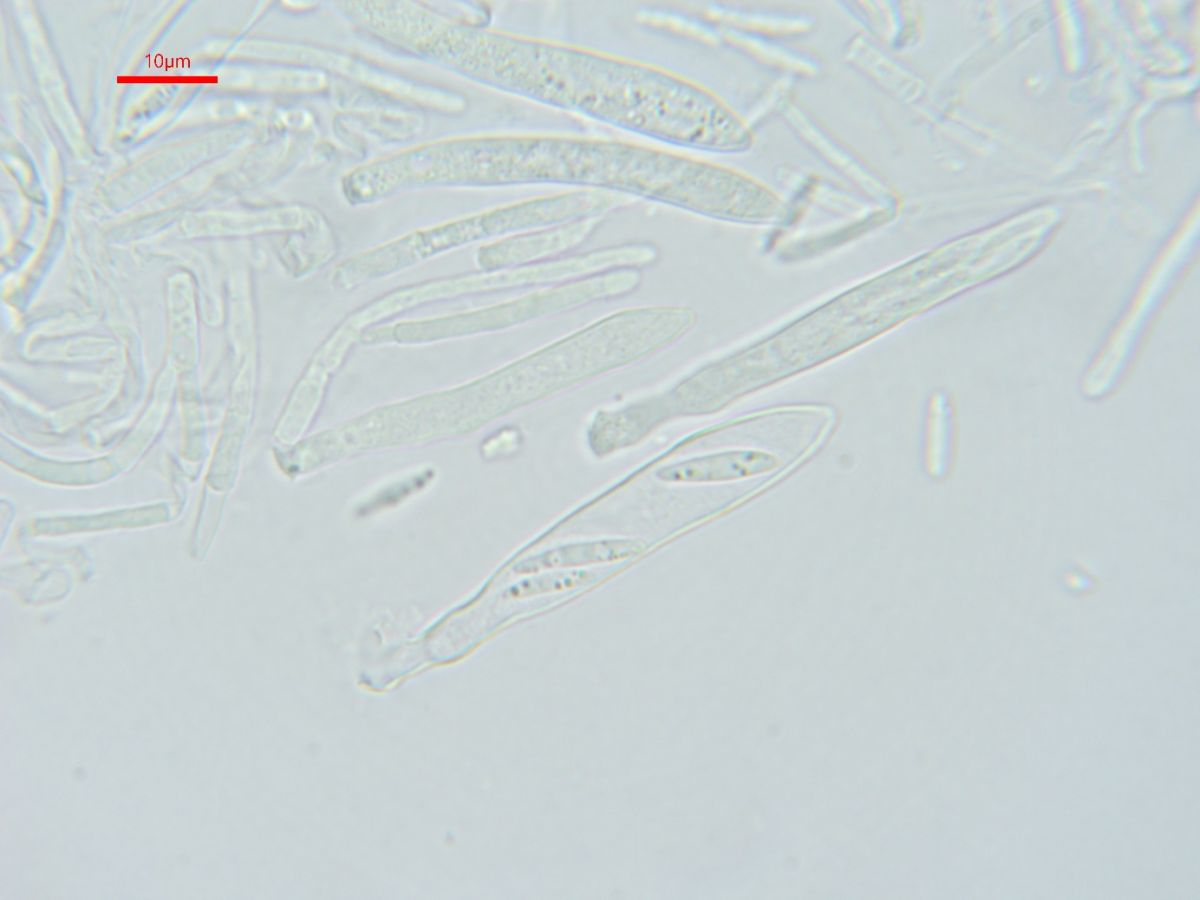 Pyrenopeziza dilutella