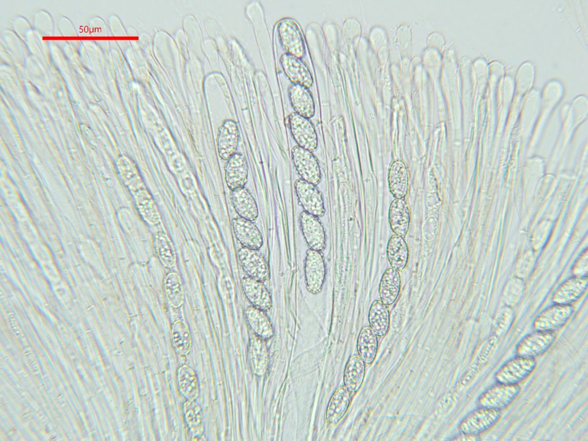 Scutellinia hirta