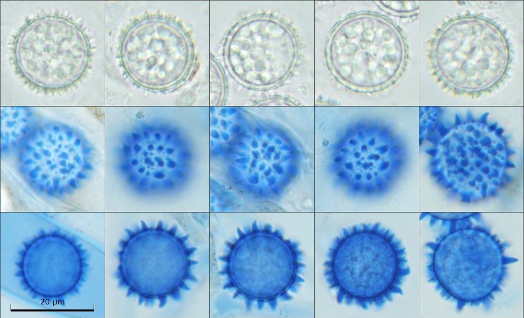 Scutellinia legaliae