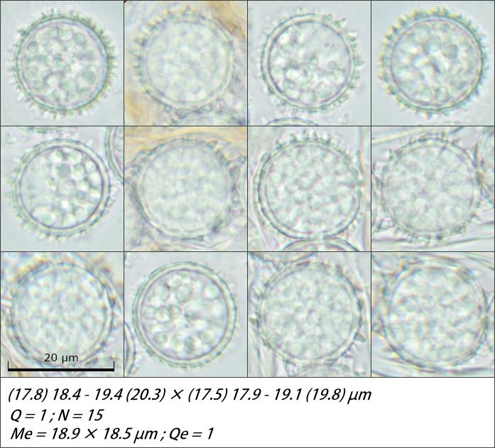 Scutellinia legaliae