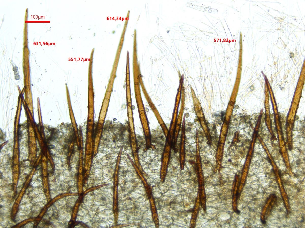 Scutellinia legaliae