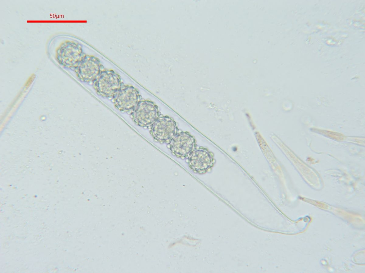 Scutellinia sinensis