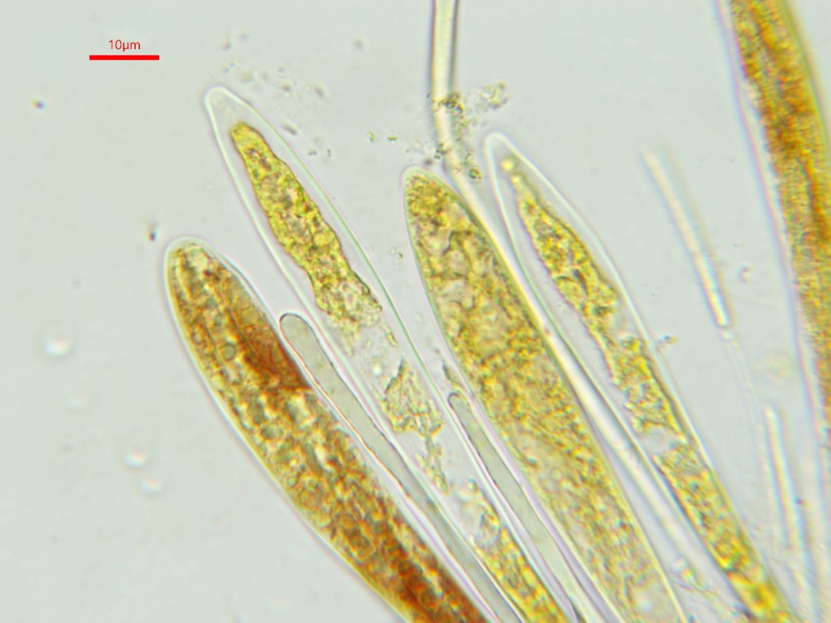 Strossmayeria basitricha