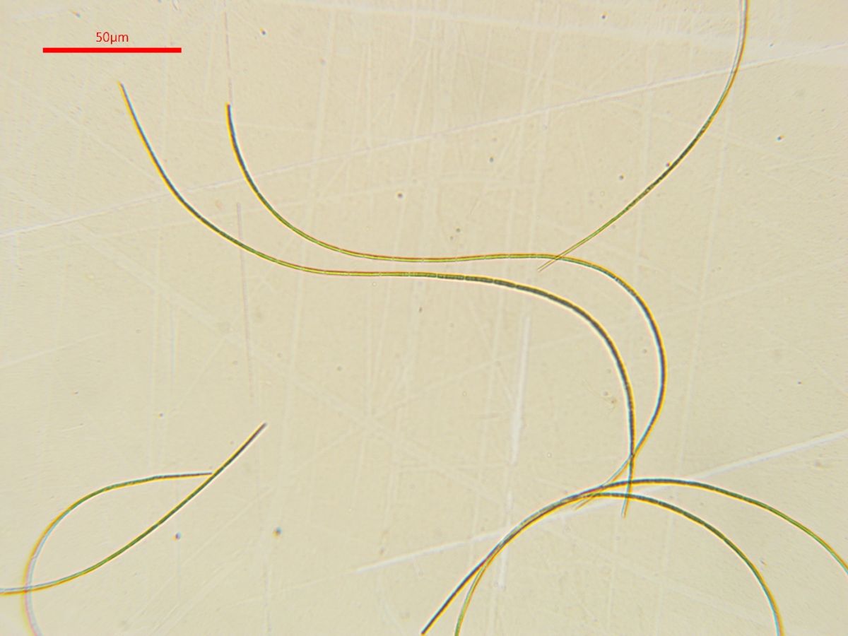 Vibrissea decolorans