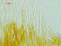 Arachnopeziza aurelia