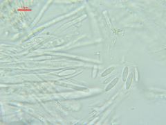 Arachnopeziza aurelia