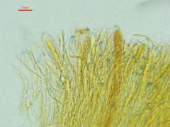 Arachnopeziza aurelia