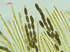 Biporispora europaea