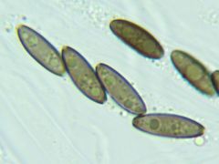 Biporispora europaea