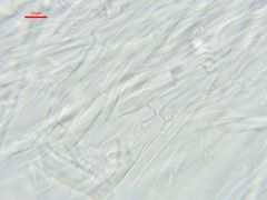 Calcipostia guttulata