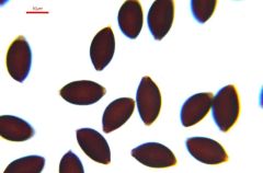 Coprinopsis rugosomagnispora