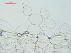 Coprinopsis rugosomagnispora