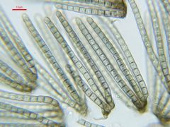 Cryptocoryneum condensatum