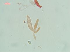 Hyalopeziza millepunctata