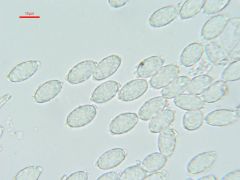 Melastiza flavorubens