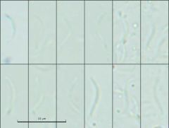 Orbilia crenatomarginata