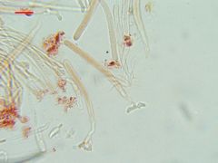 Orbilia xanthoguttulata