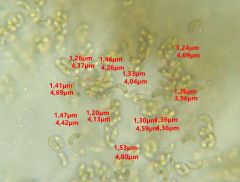 Peroneutypa scoparia