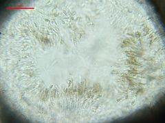 Peroneutypa scoparia