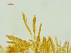 Pyrenopeziza dilutella