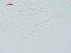 Pyrenopeziza dilutella