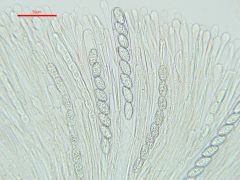 Scutellinia hirta
