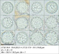 Scutellinia legaliae