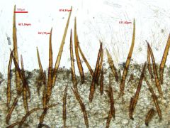 Scutellinia legaliae