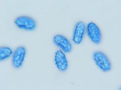 Scutellinia pseudotrechispora