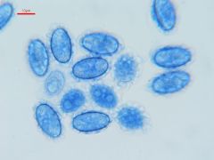 Scutellinia pseudotrechispora