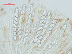 Scutellinia pseudotrechispora