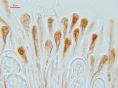 Scutellinia pseudotrechispora