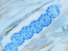 Scutellinia sinensis