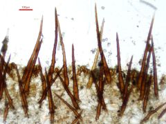 Scutellinia sinensis