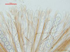 Scutellinia sinensis