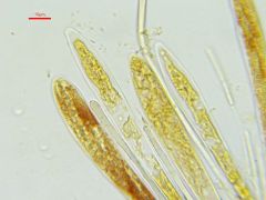Strossmayeria basitricha